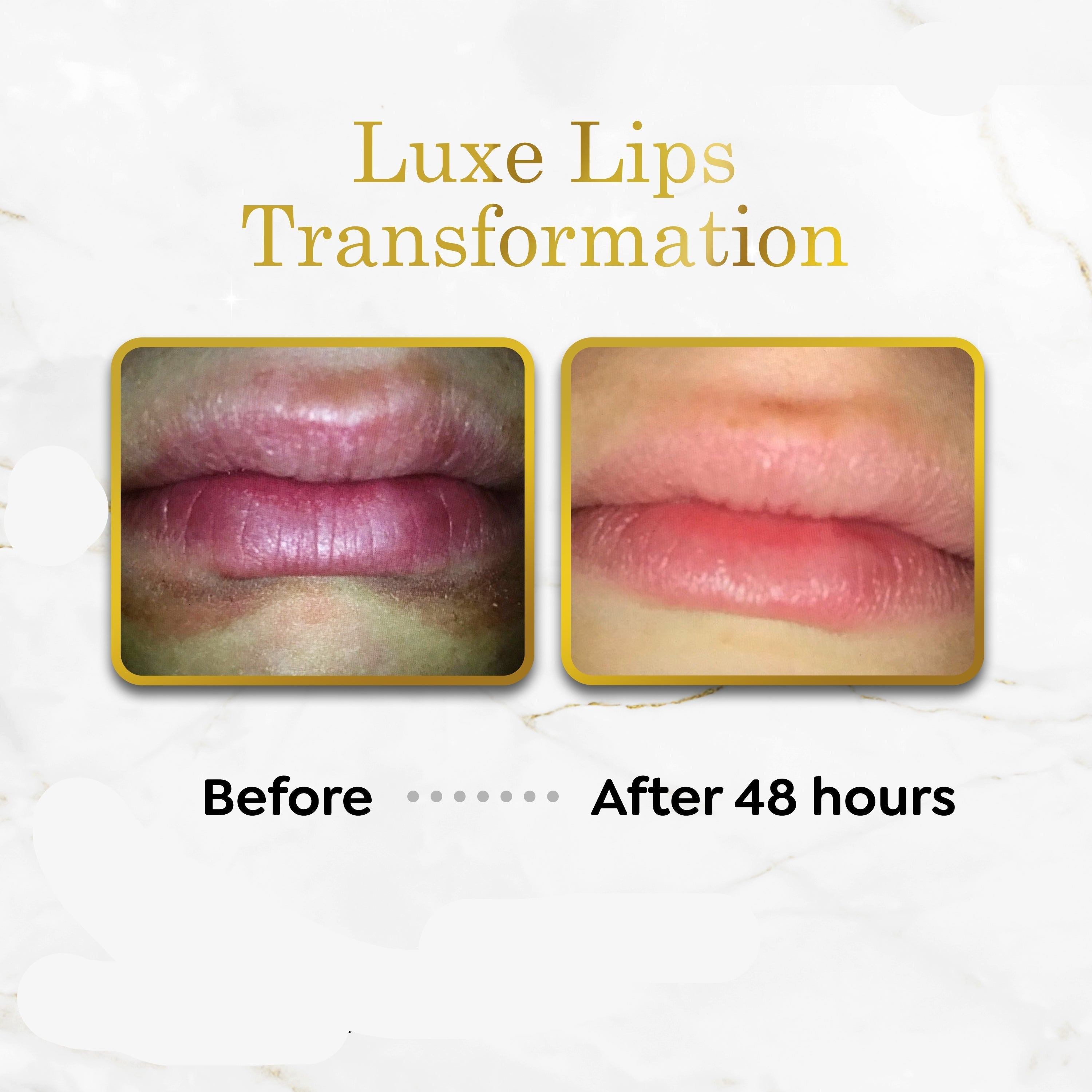 Luxe Lips - Beeswax Free, Nut Free Lip Balm - Lovely Lavender